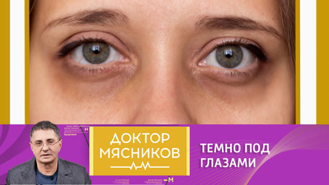 Александр Мясников развеял миф о темных кругах под глазами