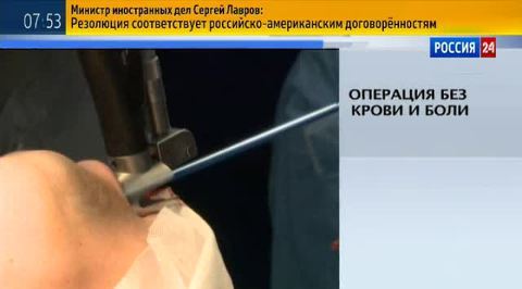 Органы в пробирках и бескровное удаление опухоли гортани