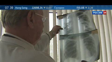 Болезни органов дыхания - в тройке самых распространенных в России