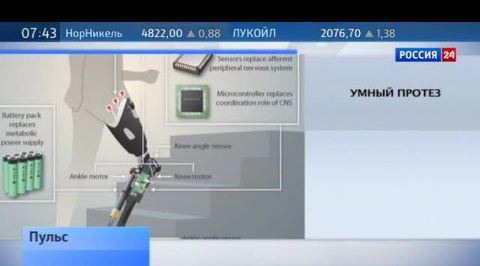 "Умные" протезы и медаль "За профессионализм и самоотверженность"