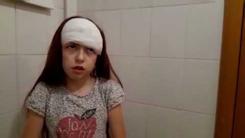 В Башкирии собака изувечила 10-летнюю девочку