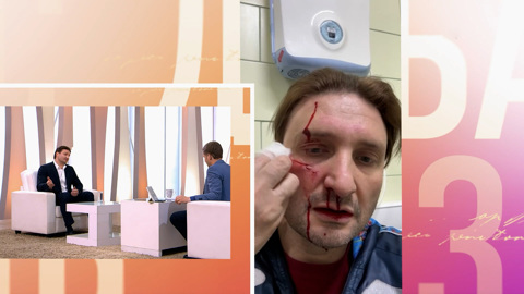 "Расслабляться нельзя". Запашный объяснил, почему на него напал тигр