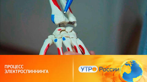 Искусственные связки