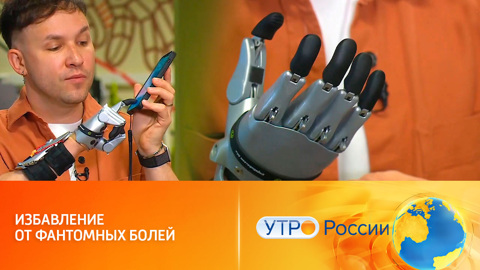 Умные протезы