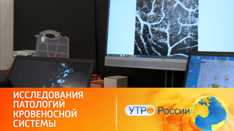 Сканирование сосудов
