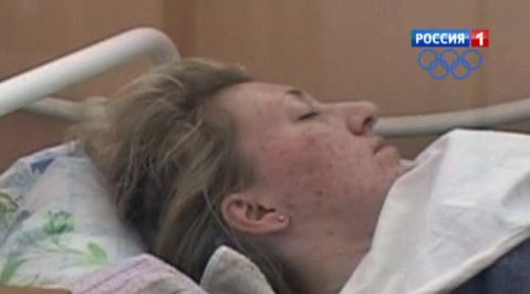 В Подольске 14 человек заболели брюшным тифом