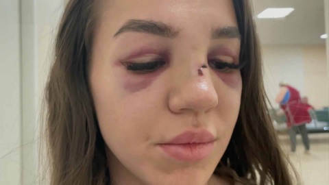 В Челябинске судят посетителя бара, избившего девушку-промоутера