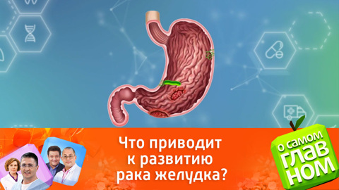 Как контролировать язву желудка, чтобы избежать рака?