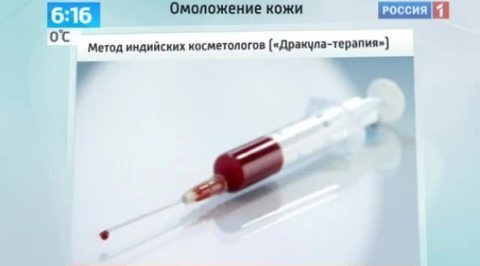Секреты красоты: "дракулотерапия" вместо ботокса