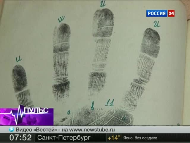О способностях человека и проблемах со здоровьем расскажут отпечатки пальцев