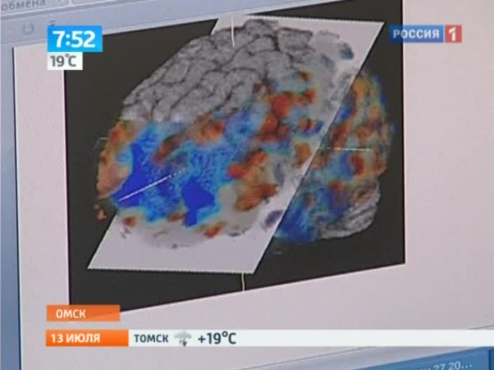 Утро России. Карта мозга