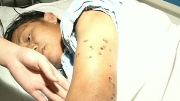 Осы-убийцы закусали насмерть 19 человек