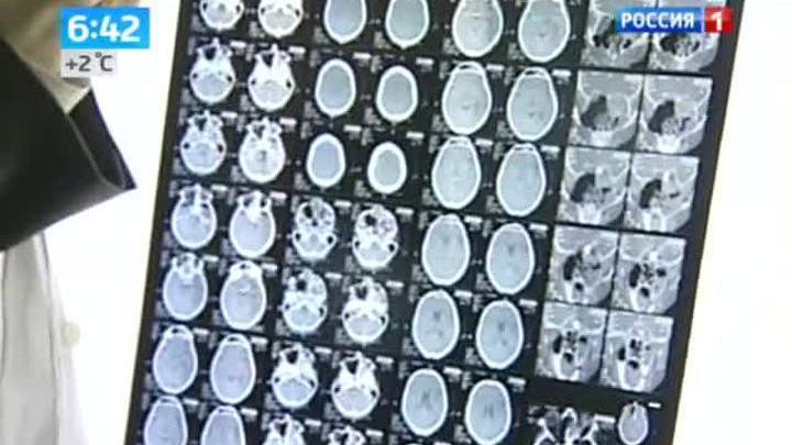Ученые: мозг человека сам вырабатывает наркотики
