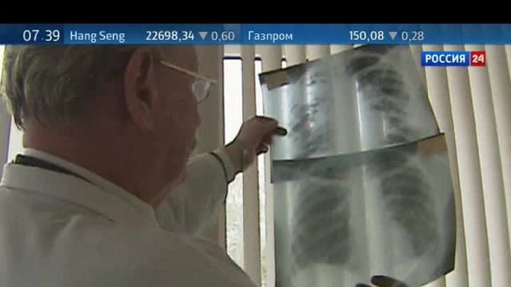 Болезни органов дыхания - в тройке самых распространенных в России
