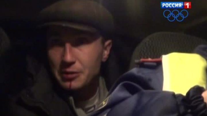 Нетрезвый автолюбитель избил себя, чтобы наказать полицейских