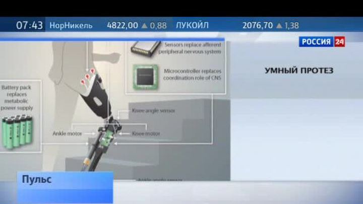 "Умные" протезы и медаль "За профессионализм и самоотверженность"