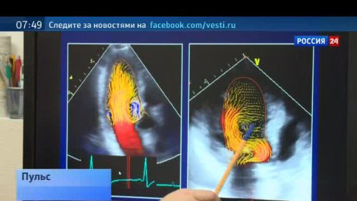 Ноу-хау столичных хирургов: ремоделирование сердца