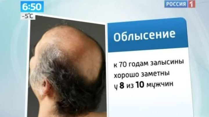 Американские ученые обнаружили "лысый ген"
