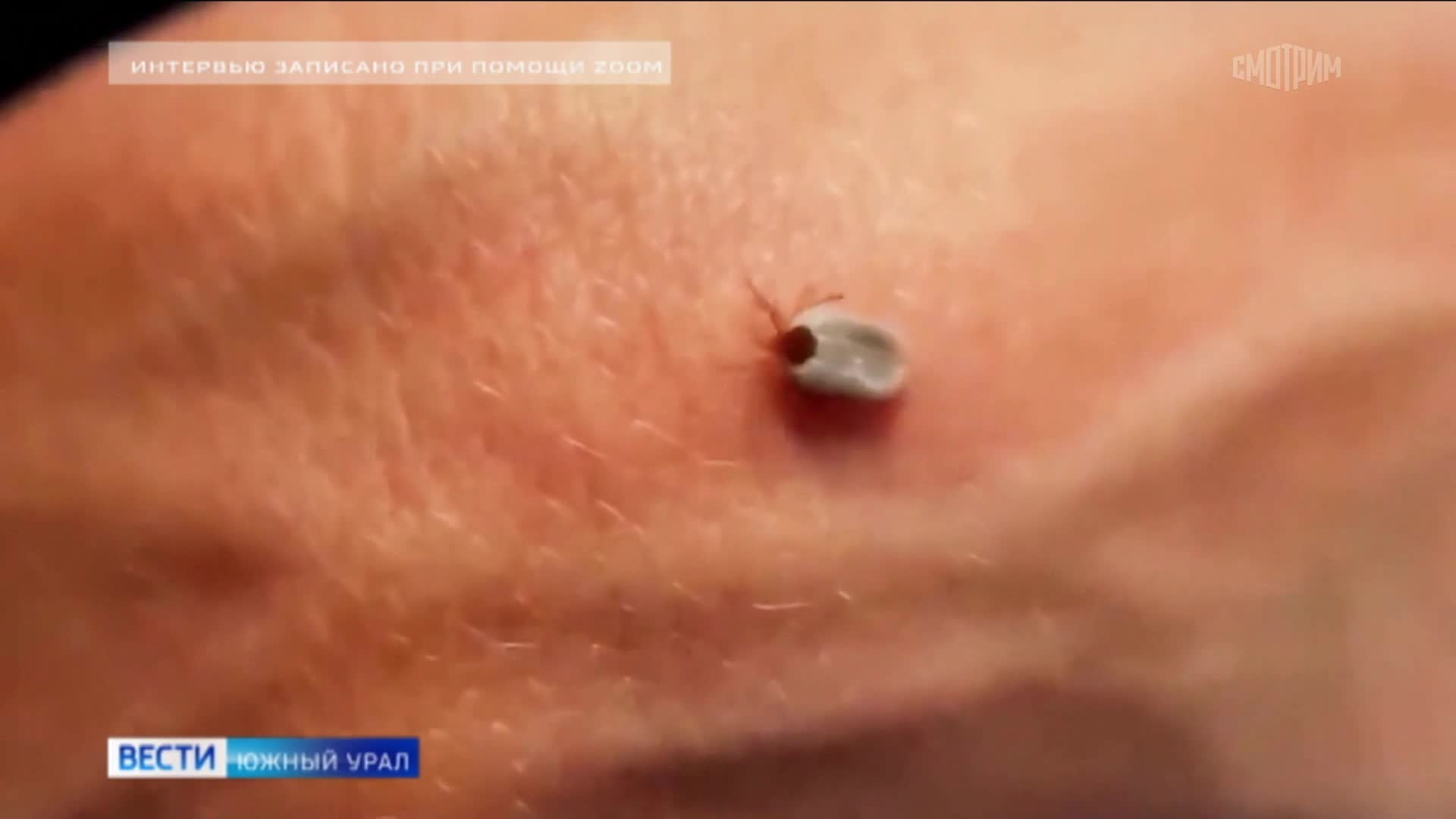 Врач из Челябинска дала советы по защите от укуса клеща