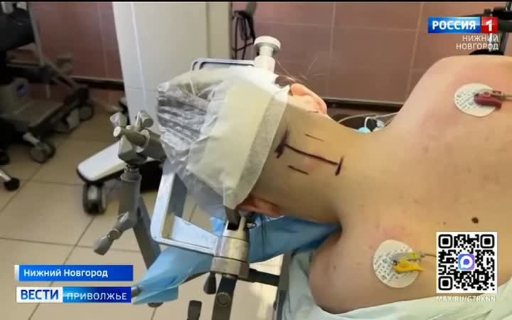 Нижегородские нейрохирурги начали выполнять операции пациентам с аномалией Киммерли
