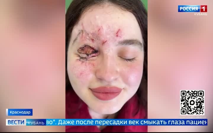 Врачи боролись 3 года, чтобы она просто начала моргать