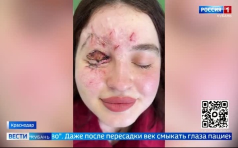 Врачи боролись 3 года, чтобы она просто начала моргать