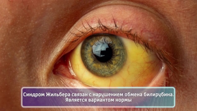 Эфир 17.04.2026
