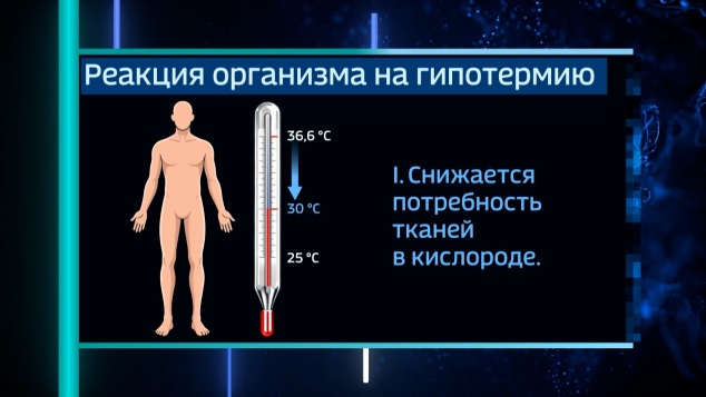 Гипотермия