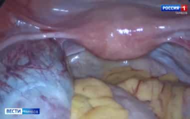 В Тамбовской областной больнице на стражу женского здоровья заступила новая эндоскопическая стойка. Она дает возможность делать сложные операции более щадящими, видеть мельчайшие детали и сокращать время вмешательства. Результат — быстрее восстановление и